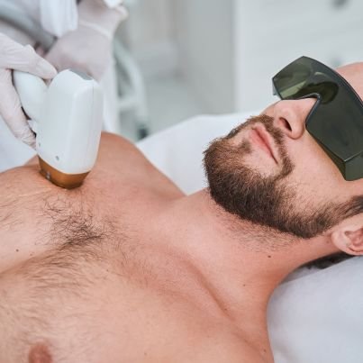 Laser Hair Removal